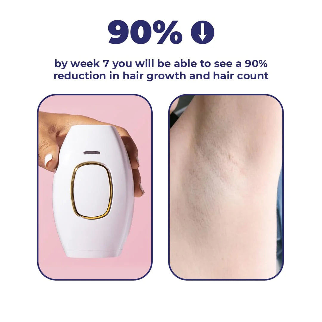 IPL hair Removal