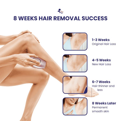 IPL hair Removal